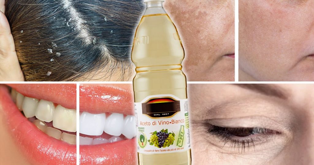 5 usi dell’aceto in cosmetica che non conoscevi